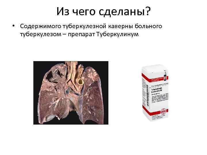 Из чего сделаны? • Содержимого туберкулезной каверны больного туберкулезом – препарат Туберкулинум 