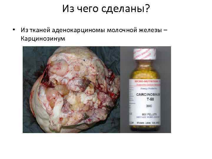 Из чего сделаны? • Из тканей аденокарциномы молочной железы – Карцинозинум 