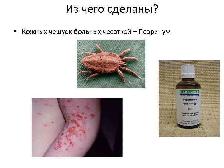 Из чего сделаны? • Кожных чешуек больных чесоткой – Псоринум 