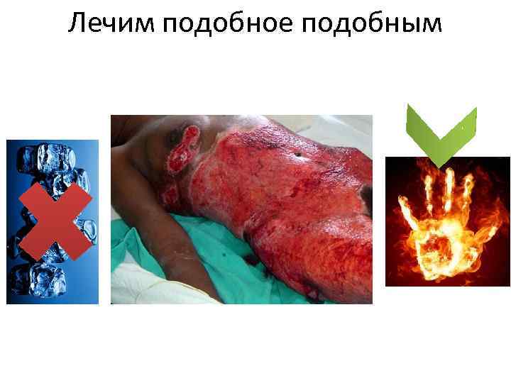 Лечим подобное подобным 