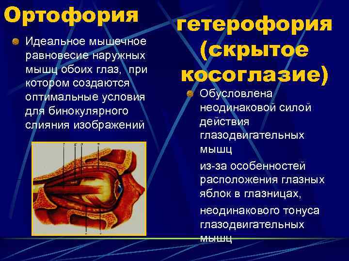 Ортофория Идеальное мышечное равновесие наружных мышц обоих глаз, при котором создаются оптимальные условия для