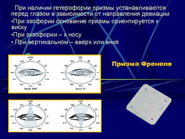 При наличии гетерофории призмы устанавливаются перед глазом в зависимости от направления девиации • При