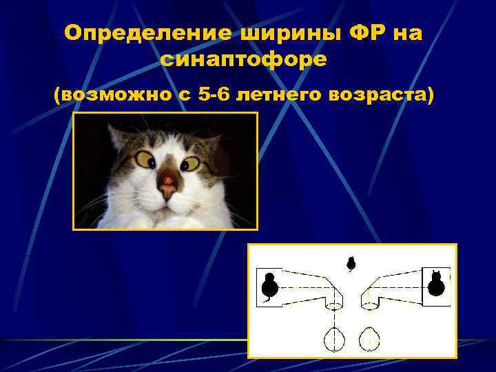 Определение ширины ФР на синаптофоре (возможно с 5 -6 летнего возраста) 