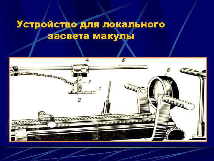 Устройство для локального засвета макулы 