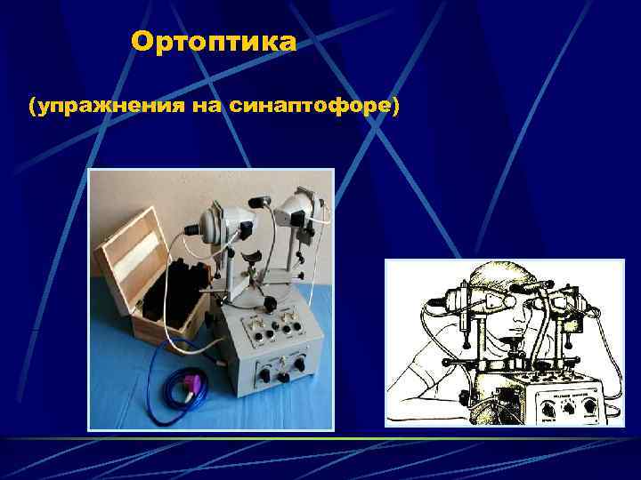 Ортоптика (упражнения на синаптофоре) 