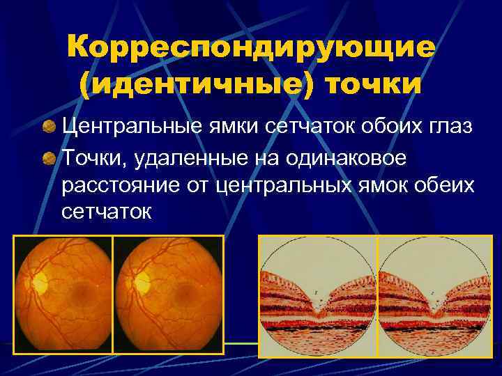 Корреспондирующие (идентичные) точки Центральные ямки сетчаток обоих глаз Точки, удаленные на одинаковое расстояние от