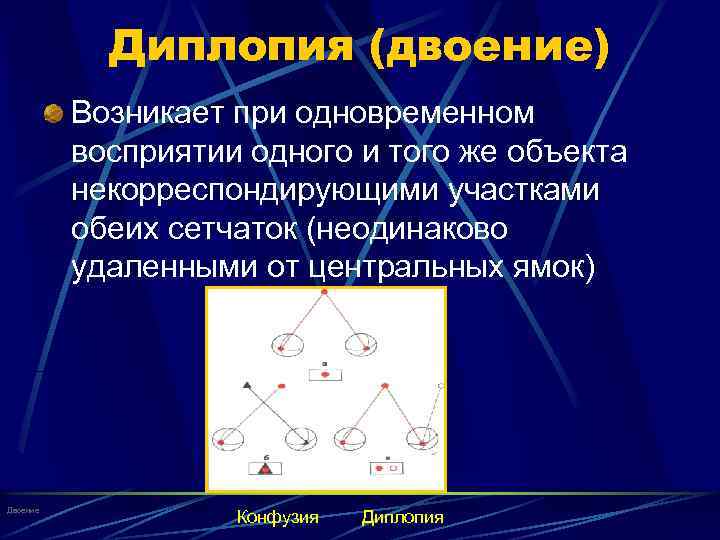 Диплопия (двоение) Возникает при одновременном восприятии одного и того же объекта некорреспондирующими участками обеих