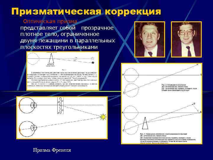 Призматическая коррекция Оптическая призма представляет собой прозрачное плотное тело, ограниченное двумя лежащими в параллельных