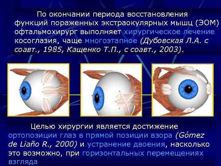 По окончании периода восстановления функций пораженных экстраокулярных мышц (ЭОМ) офтальмохирург выполняет хирургическое лечение косоглазия,