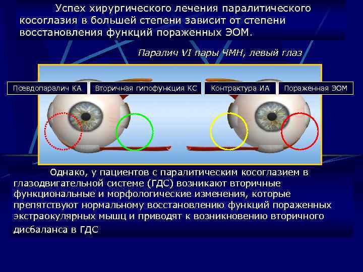 Успех хирургического лечения паралитического косоглазия в большей степени зависит от степени восстановления функций пораженных