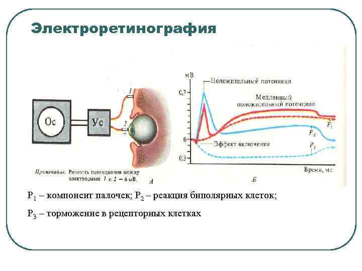 Электроретинография Р 1 – компонент палочек; Р 2 – реакция биполярных клеток; Р 3