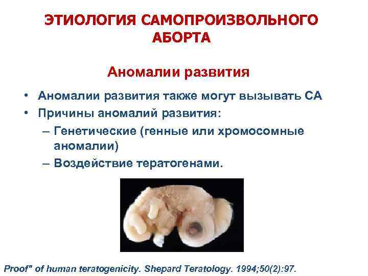 ЭТИОЛОГИЯ САМОПРОИЗВОЛЬНОГО АБОРТА Аномалии развития • Аномалии развития также могут вызывать СА • Причины