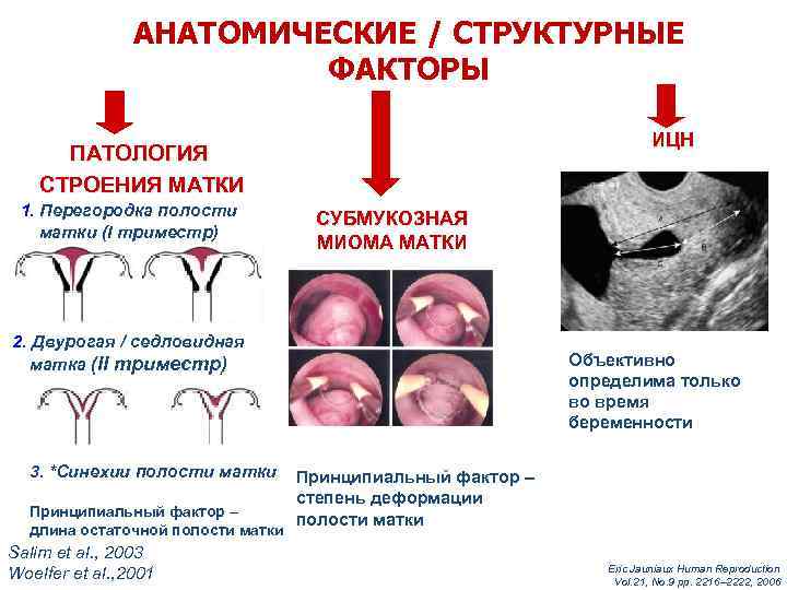 АНАТОМИЧЕСКИЕ / СТРУКТУРНЫЕ ФАКТОРЫ ИЦН ПАТОЛОГИЯ СТРОЕНИЯ МАТКИ 1. Перегородка полости матки (I триместр)