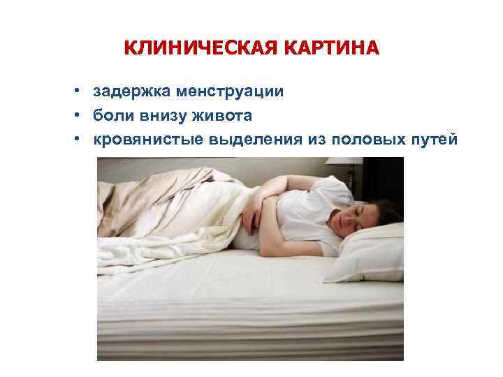 КЛИНИЧЕСКАЯ КАРТИНА • задержка менструации • боли внизу живота • кровянистые выделения из половых