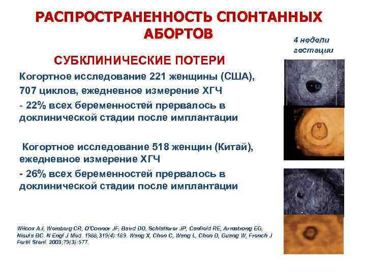 РАСПРОСТРАНЕННОСТЬ СПОНТАННЫХ АБОРТОВ 4 недели СУБКЛИНИЧЕСКИЕ ПОТЕРИ Когортное исследование 221 женщины (США), 707 циклов,
