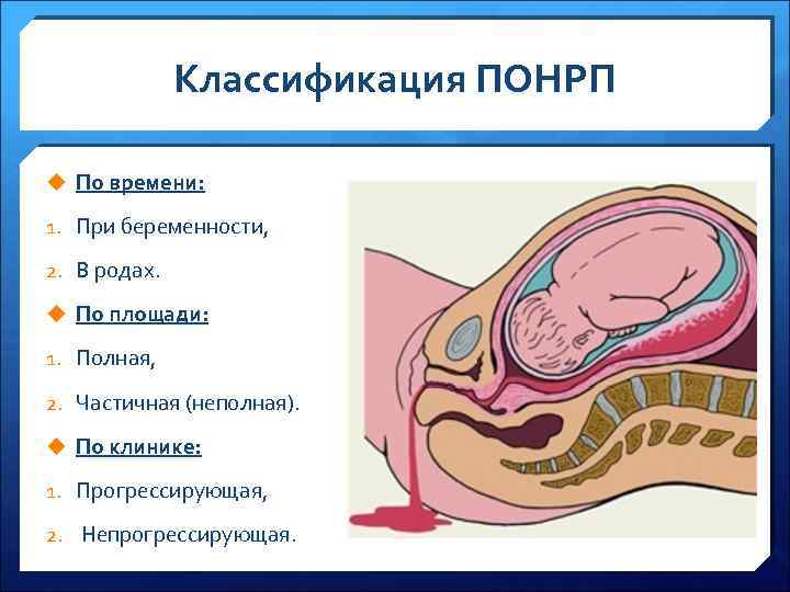 Преждевременная отслойка плаценты презентация