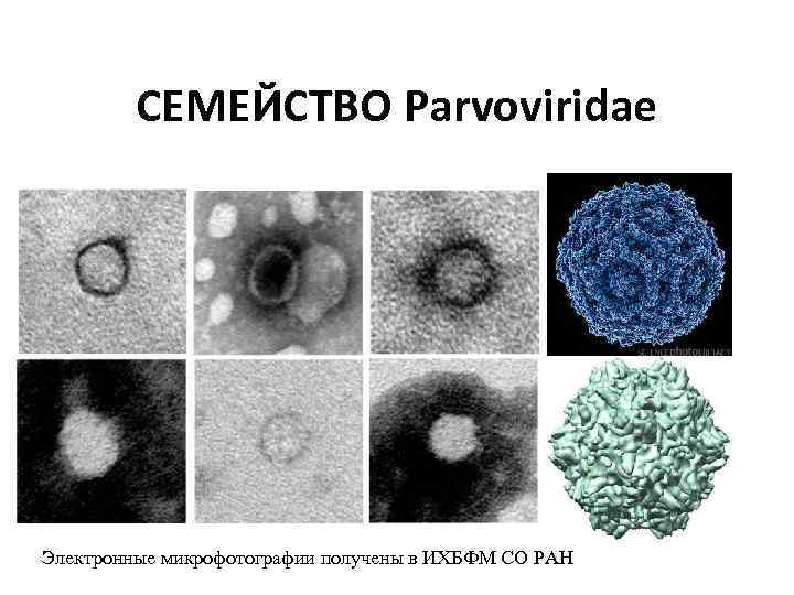 СЕМЕЙСТВО Parvoviridae Электронные микрофотографии получены в ИХБФМ СО РАН 