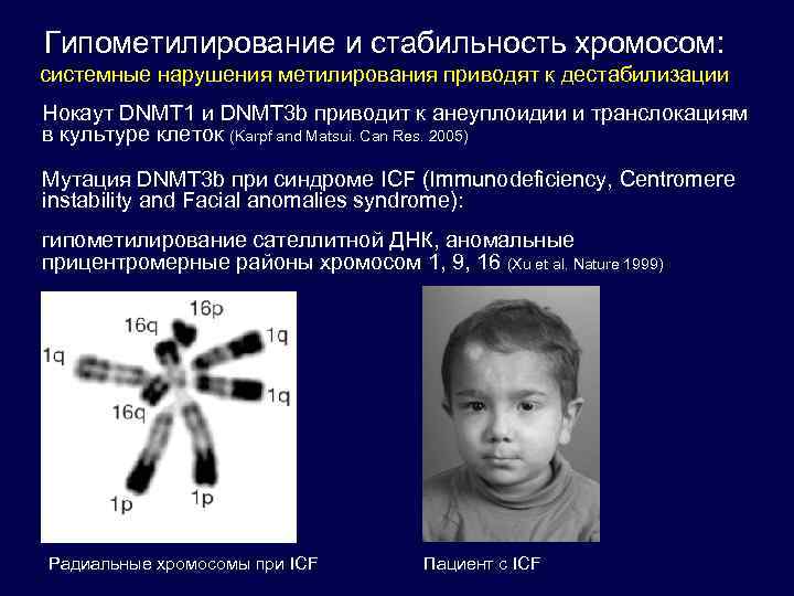 Гипометилирование и стабильность хромосом: системные нарушения метилирования приводят к дестабилизации Нокаут DNMT 1 и