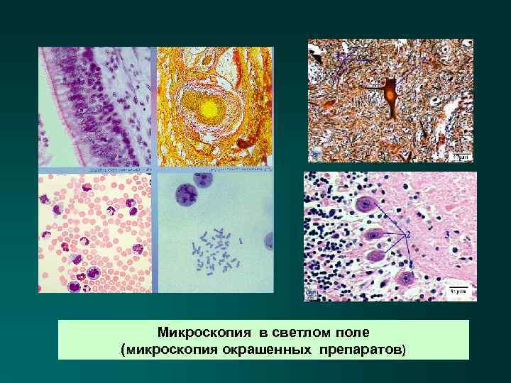 Микроскопия в светлом поле (микроскопия окрашенных препаратов) 