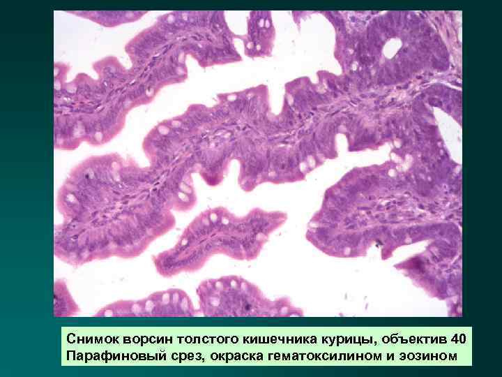 Снимок ворсин толстого кишечника курицы, объектив 40 Парафиновый срез, окраска гематоксилином и эозином 