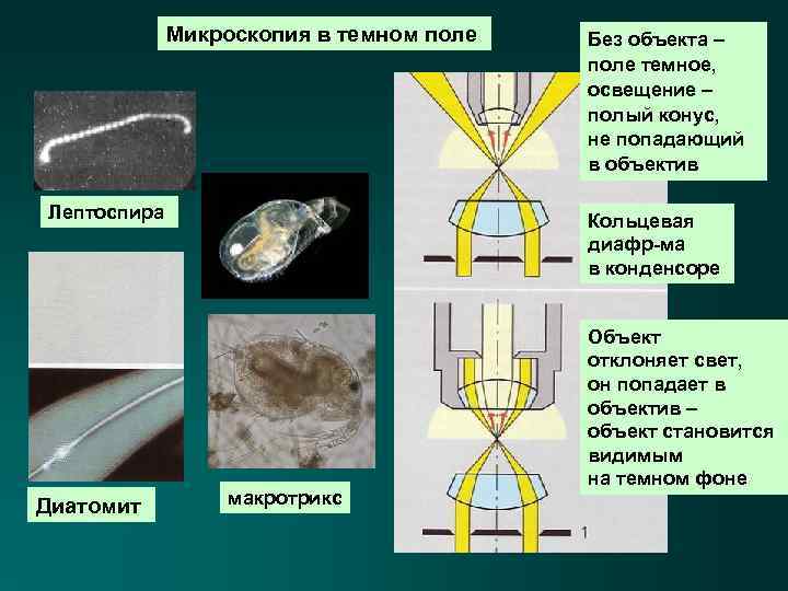 Микроскопия в темном поле Лептоспира Диатомит Без объекта – поле темное, освещение – полый