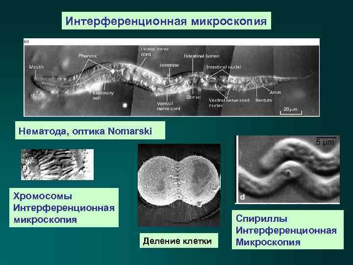 Интерференционная микроскопия Нематода, оптика Nomarski Хромосомы Интерференционная микроскопия Деление клетки Спириллы Интерференционная Микроскопия 