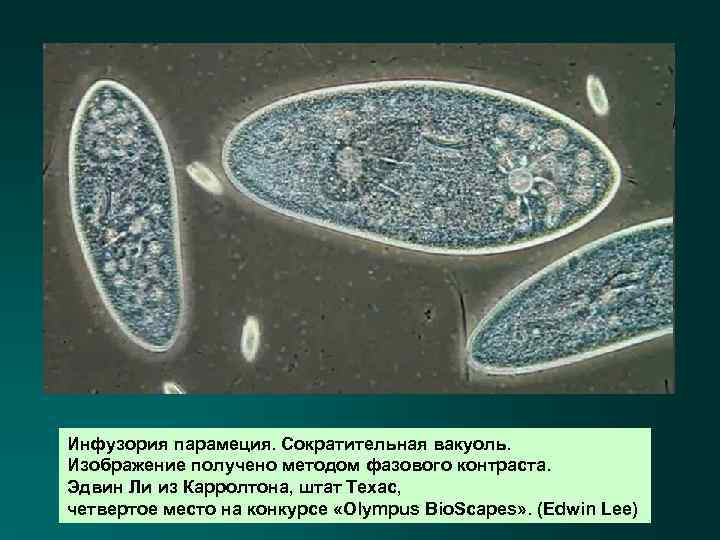 Инфузория парамеция. Сократительная вакуоль. Изображение получено методом фазового контраста. Эдвин Ли из Карролтона, штат