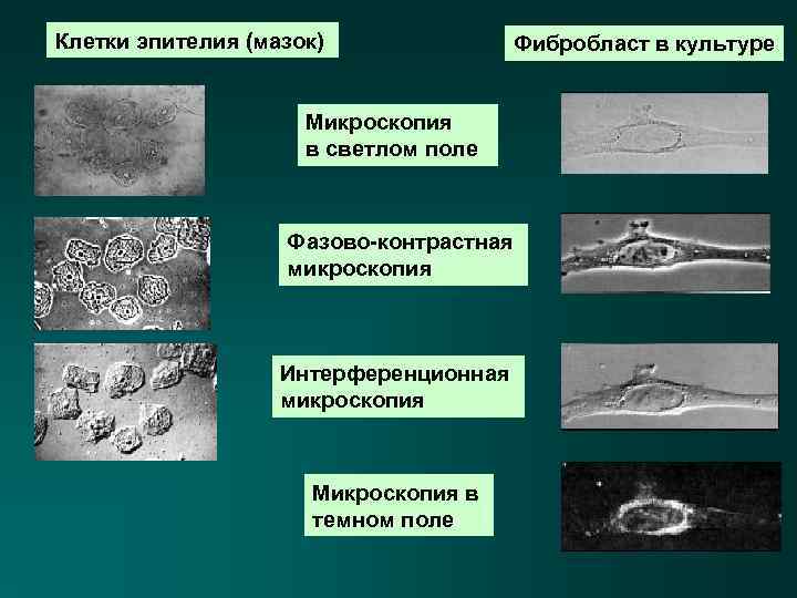 Клетки эпителия (мазок) Фибробласт в культуре Микроскопия в светлом поле Фазово-контрастная микроскопия Интерференционная микроскопия