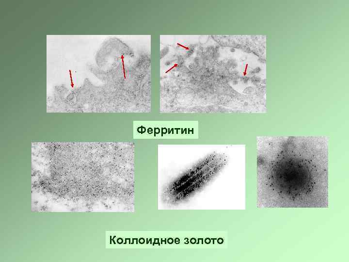 Ферритин Коллоидное золото 