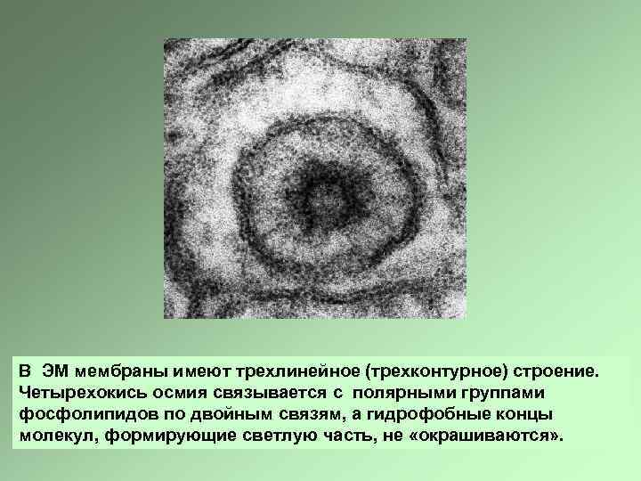 В ЭМ мембраны имеют трехлинейное (трехконтурное) строение. Четырехокись осмия связывается с полярными группами фосфолипидов