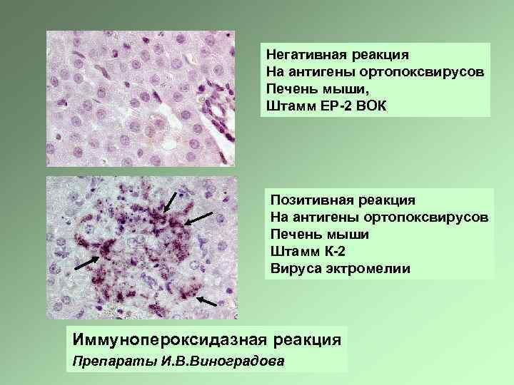 Негативная реакция На антигены ортопоксвирусов Печень мыши, Штамм ЕР-2 ВОК Позитивная реакция На антигены