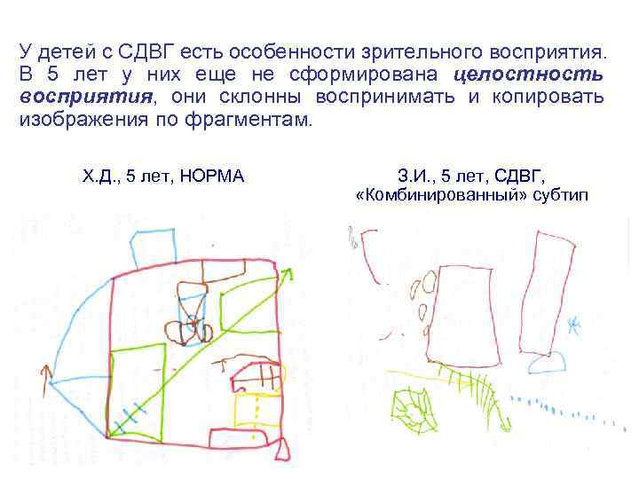 У детей с СДВГ есть особенности зрительного восприятия. В 5 лет у них еще