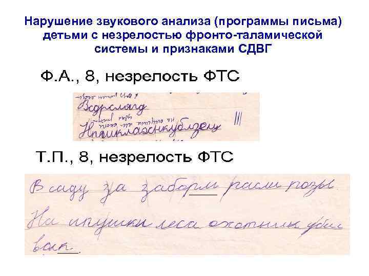 Нарушение звукового анализа (программы письма) детьми с незрелостью фронто-таламической системы и признаками СДВГ 