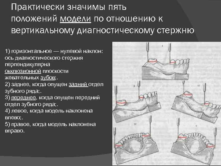 Практически значимы пять положений модели по отношению к вертикальному диагностическому стержню 1) горизонтальное —