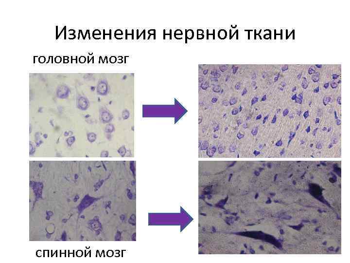 Изменения нервной ткани головной мозг спинной мозг 