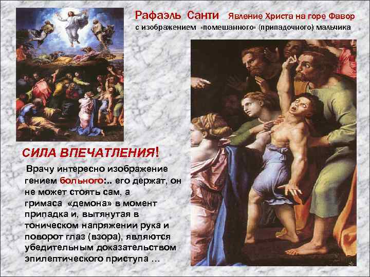 Рафаэль Санти Явление Христа на горе Фавор с изображением «помешанного» (припадочного) мальчика СИЛА ВПЕЧАТЛЕНИЯ!