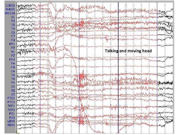 Talking and moving head 