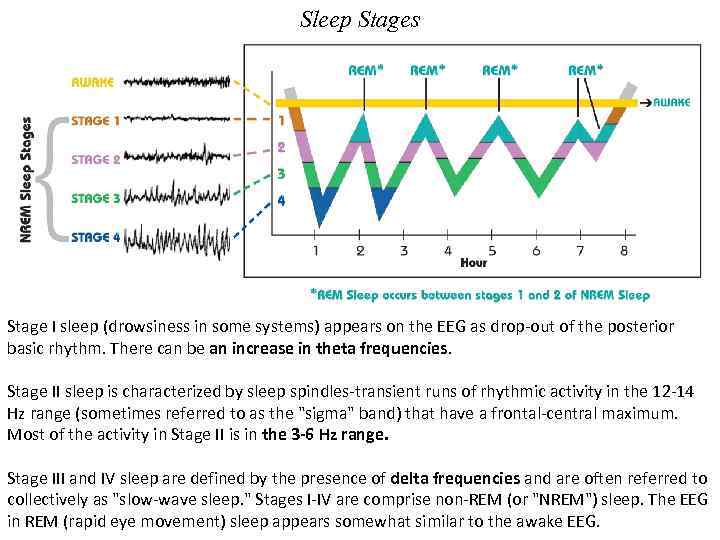 Sleep Stages Stage I sleep (drowsiness in some systems) appears on the EEG as