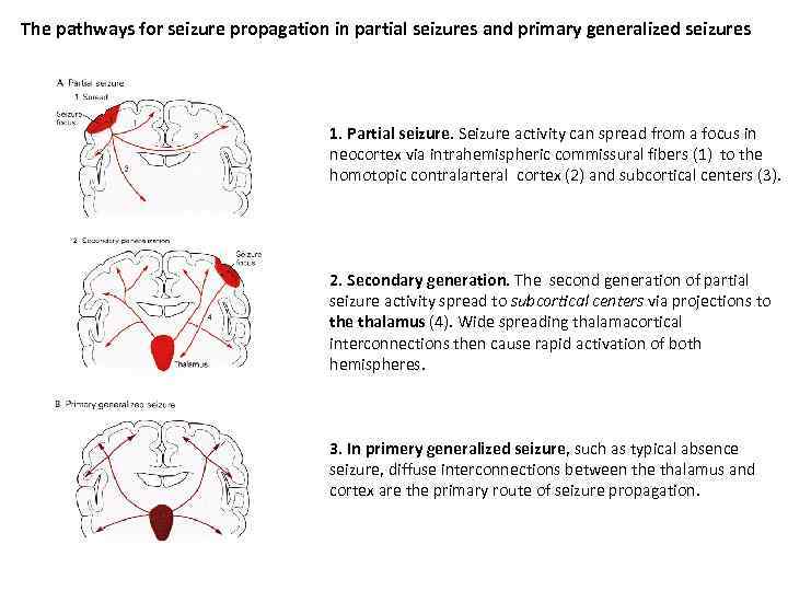 The pathways for seizure propagation in partial seizures and primary generalized seizures 1. Partial