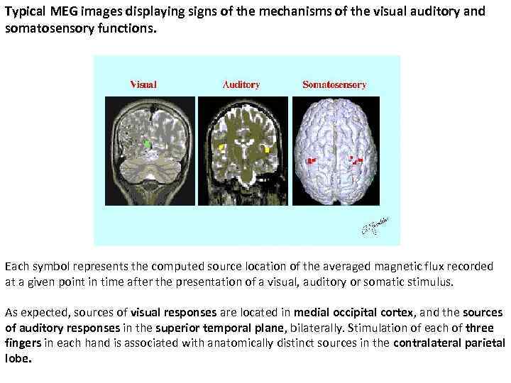 Typical MEG images displaying signs of the mechanisms of the visual auditory and somatosensory