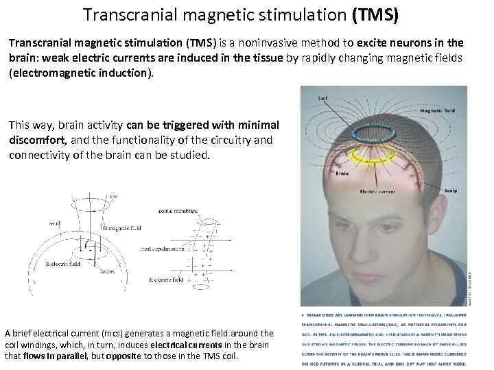 Transcranial magnetic stimulation (TMS) is a noninvasive method to excite neurons in the brain: