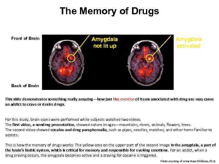 The Memory of Drugs Front of Brain Amygdala not lit up Amygdala activated Back