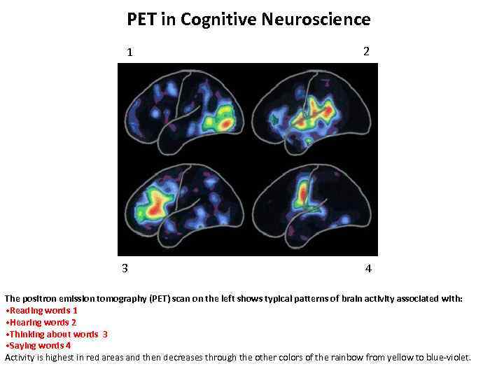 PET in Cognitive Neuroscience 1 3 2 4 The positron emission tomography (PET) scan