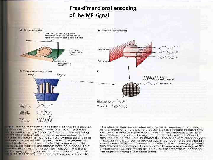 Tree-dimensional encoding of the MR signal 