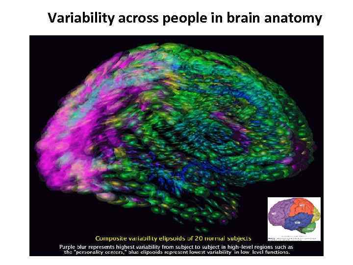 Variability across people in brain anatomy 