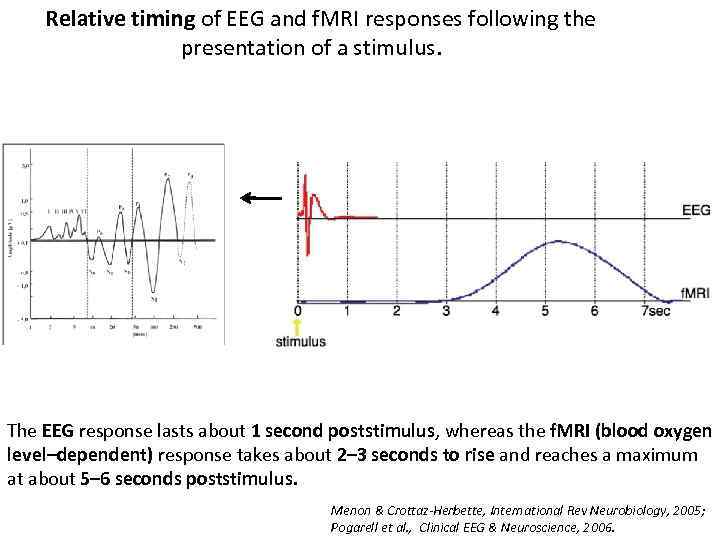  Relative timing of EEG and f. MRI responses following the presentation of a