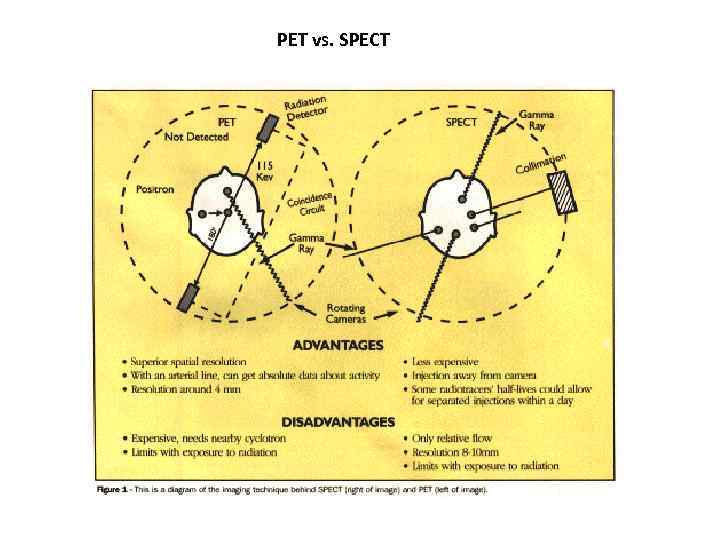 PET vs. SPECT 