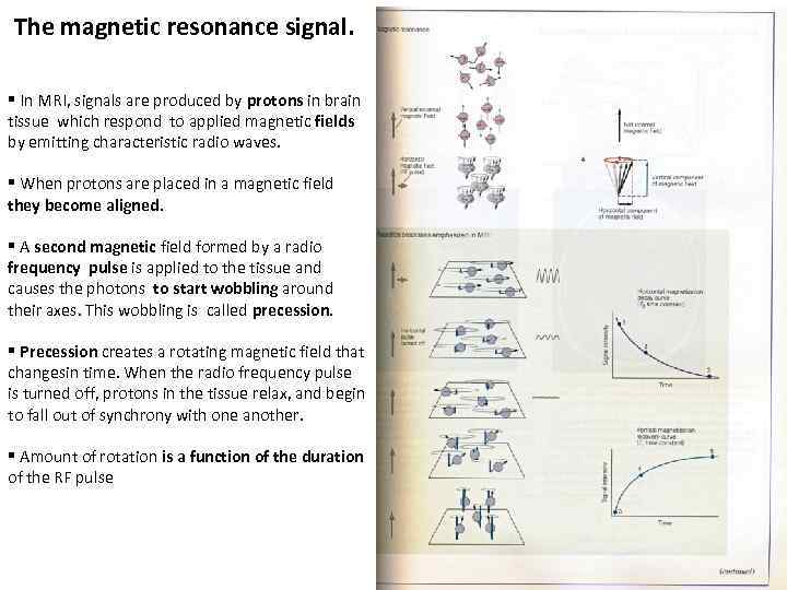 The magnetic resonance signal. § In MRI, signals are produced by protons in brain