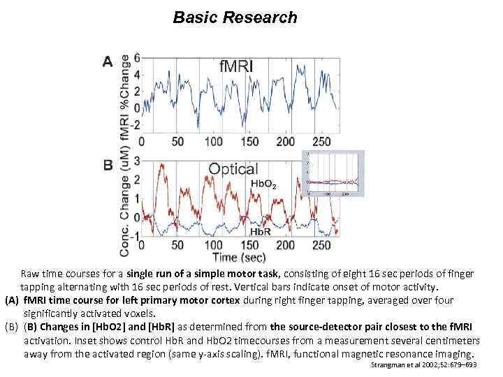 Basic Research Raw time courses for a single run of a simple motor task,