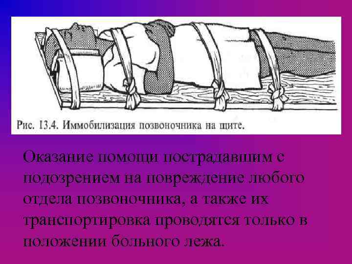 Что означает иммобилизация пострадавшего. Иммобилизация при переломе костей таза. Иммобилизация спины. Иммобилизация позвоночника на щите.